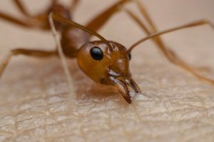 Quali sono le punture più dolorose?