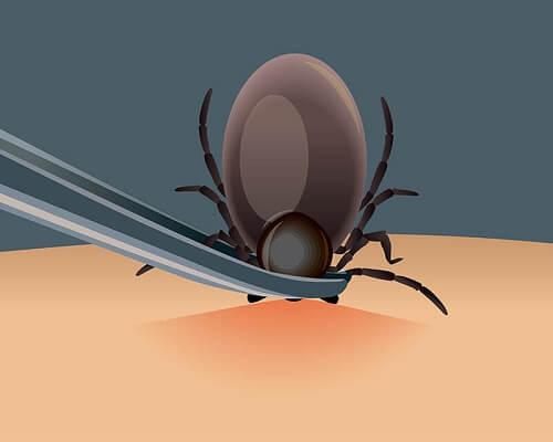 Zecche e malattia di Lyme