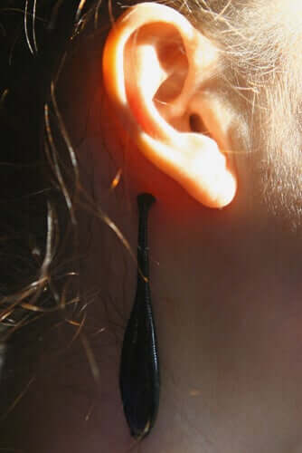 Applicazione medica delle sanguisughe dietro le orecchie