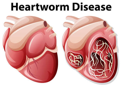 Cardiopatia da verme del cuore