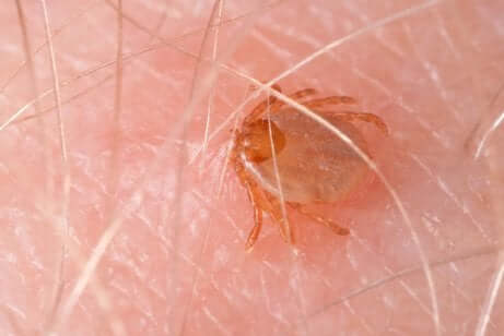 Anche le zecche possono trasmettere alcune malattie zoonotiche. Zecca sulla pelle di una persona.
