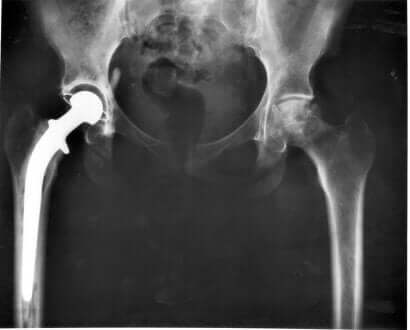 Radiografia per rilevare la displasia della anca nel cane. 