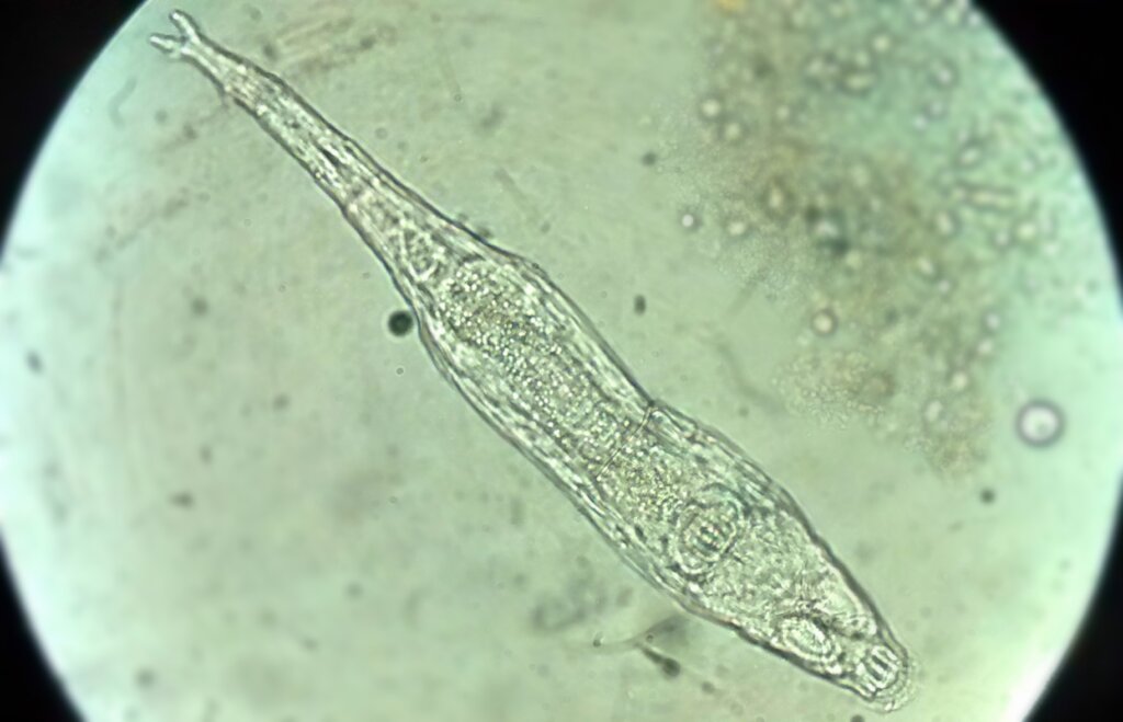 Bdelloidea: microrganismo di 24.000 anni fa tornato in vita